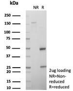 CD74 (B-Cell Marker) (Transcription Regulator) Antibody in SDS-PAGE (SDS-PAGE)