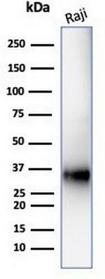 CD74 (B-Cell Marker) (Transcription Regulator) Antibody in Western Blot (WB)