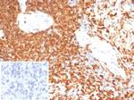 CD74 (B-Cell Marker) (Transcription Regulator) Antibody in Immunohistochemistry (Paraffin) (IHC (P))