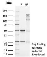 CD74 (B-Cell Marker) (Transcription Regulator) Antibody in SDS-PAGE (SDS-PAGE)