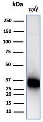 CD74 (B-Cell Marker) (Transcription Regulator) Antibody in Western Blot (WB)