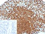 CD74 (B-Cell Marker) (Transcription Regulator) Antibody in Immunohistochemistry (Paraffin) (IHC (P))