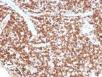 CD74 Antibody in Immunohistochemistry (Paraffin) (IHC (P))