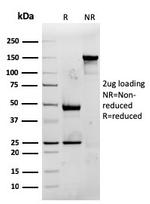 CD74 Antibody in SDS-PAGE (SDS-PAGE)