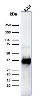 CD74 Antibody in Western Blot (WB)