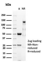 CD74 (B-Cell Marker) Antibody in SDS-PAGE (SDS-PAGE)