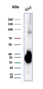 CD74 (B-Cell Marker) (Transcription Regulator) Antibody in Western Blot (WB)