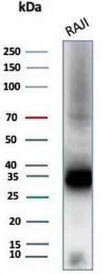 CD74 (B-Cell Marker) (Transcription Regulator) Antibody in Western Blot (WB)