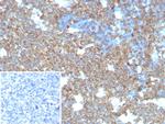 CD74 (B-Cell Marker) (Transcription Regulator) Antibody in Immunohistochemistry (Paraffin) (IHC (P))