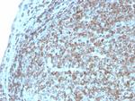 CD74 Antibody in Immunohistochemistry (Paraffin) (IHC (P))