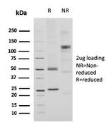 CD74 Antibody in SDS-PAGE (SDS-PAGE)