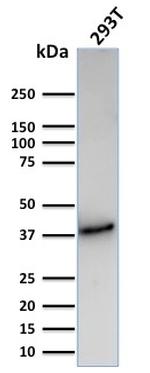 CD74 Antibody in Western Blot (WB)