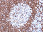 CD79a (B-Cell Marker) Antibody in Immunohistochemistry (Paraffin) (IHC (P))