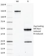 CD79a (B-Cell Marker) Antibody in SDS-PAGE (SDS-PAGE)