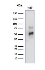 CD79a (B-Cell Marker) Antibody in Western Blot (WB)