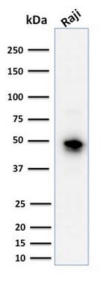 CD79a (B-Cell Marker) Antibody in Western Blot (WB)