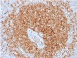 CD79a (B-Cell Marker) Antibody in Immunohistochemistry (Paraffin) (IHC (P))