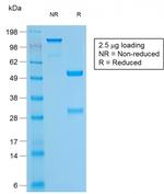 CD79a (B-Cell Marker) Antibody in SDS-PAGE (SDS-PAGE)