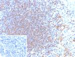 CD79a (B-Cell Marker) Antibody in Immunohistochemistry (Paraffin) (IHC (P))