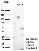 CD79a (B-Cell Marker) Antibody in SDS-PAGE (SDS-PAGE)