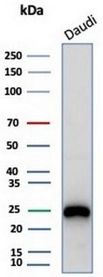 CD79a (B-Cell Marker) Antibody in Western Blot (WB)