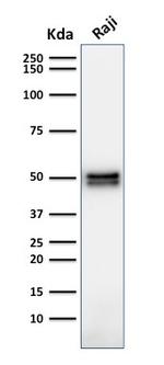 CD79a (B-Cell Marker) Antibody in Western Blot (WB)