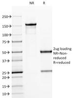 CD79a (B-Cell Marker) Antibody in SDS-PAGE (SDS-PAGE)