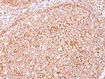 CD79a (B-Cell Marker) Antibody in Immunohistochemistry (Paraffin) (IHC (P))