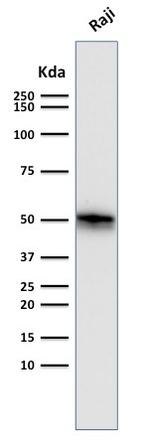 CD79a (B-Cell Marker) Antibody in Western Blot (WB)