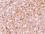 CD79a (B Cell Marker) Antibody in Immunohistochemistry (Paraffin) (IHC (P))