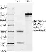 CD79a (B Cell Marker) Antibody in SDS-PAGE (SDS-PAGE)