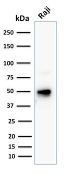 CD79a (B Cell Marker) Antibody in Western Blot (WB)