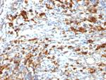 CD79a (B Cell Marker) Antibody in Immunohistochemistry (Paraffin) (IHC (P))