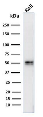 CD79a (B Cell Marker) Antibody in Western Blot (WB)