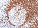 CD79a (B-Cell Marker) Antibody in Immunohistochemistry (Paraffin) (IHC (P))