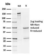 CD79a (B-Cell Marker) Antibody in SDS-PAGE (SDS-PAGE)