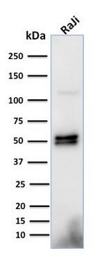 CD79a (B-Cell Marker) Antibody in Western Blot (WB)