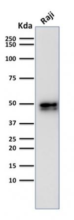 CD79a (B-Cell Marker) Antibody in Western Blot (WB)