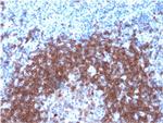 CD79a (B-Cell Marker) Antibody in Immunohistochemistry (Paraffin) (IHC (P))