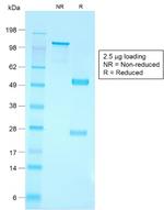 CD79a (B-Cell Marker) Antibody in SDS-PAGE (SDS-PAGE)