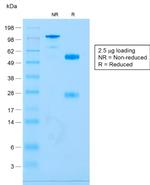 CD79a Antibody in SDS-PAGE (SDS-PAGE)