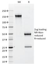 CD79b Antibody in SDS-PAGE (SDS-PAGE)