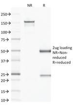 CD79b Antibody in SDS-PAGE (SDS-PAGE)