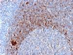 CD79b (B-Cell Marker) Antibody in Immunohistochemistry (Paraffin) (IHC (P))