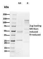 CD79b (B-Cell Marker) Antibody in SDS-PAGE (SDS-PAGE)