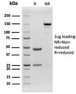 CD79b (B-Cell Marker) Antibody in SDS-PAGE (SDS-PAGE)