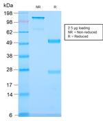 CD79b (B-Cell Marker) Antibody in SDS-PAGE (SDS-PAGE)