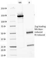 Major Vault Protein (MVP) Antibody in SDS-PAGE (SDS-PAGE)