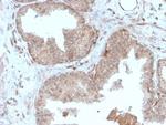 Major Vault Protein (MVP) Antibody in Immunohistochemistry (Paraffin) (IHC (P))