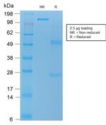 TNFS15/VEGI (Vascular Endothelial Growth Inhibitor) Antibody in SDS-PAGE (SDS-PAGE)